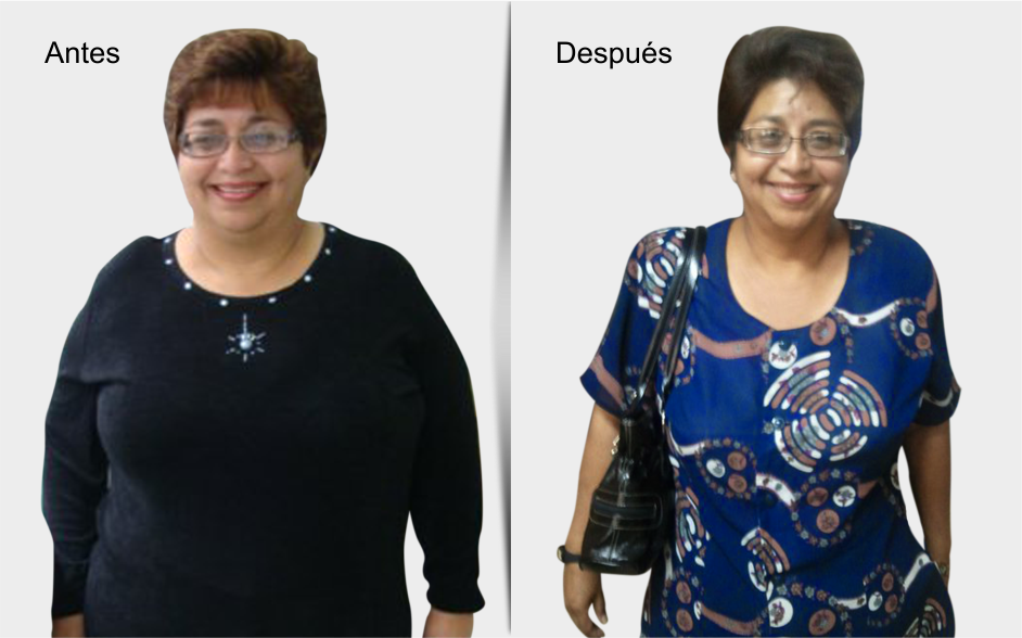 Dr. Antonio Lahoud | Cirujano bariátrico y metabólico. | Testimonios | Magaly Rosales antes y después de la cirugía de manga gástrica | Lima - Perú